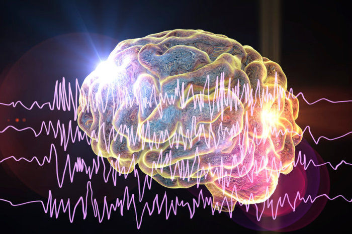 Novo agente reduz convulsões em epilepsia resistente ao tratamento