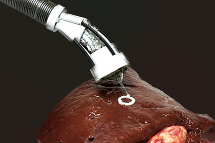 Bioimpressão 3D dentro do corpo humano pode ser possível graças a um novo dispositivo robótico macio e flexível