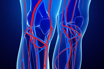 Cirurgia é melhor que terapia endovascular para a maioria dos pacientes com isquemia que ameaça os membros