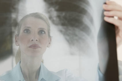 Corticosteroides para pacientes hospitalizados com pneumonia grave adquirida na comunidade: é hora de mudar a prática clínica?