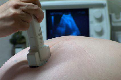 Descobertas preliminares n&atilde;o sinalizaram problemas de seguran&ccedil;a da vacina de mRNA contra a Covid-19 em gr&aacute;vidas
