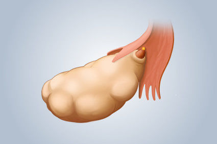 Dor pélvica ou abdominal, edema abdominal, dificuldade de se alimentar e urgência para urinar podem ser sintomas precoces do câncer de ovário