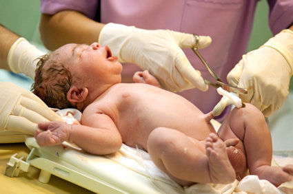 Esperar pelo menos 2 minutos para clampear o cord&atilde;o umbilical melhora as taxas de sobreviv&ecirc;ncia de prematuros