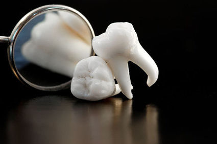 Estudo sugere caminho conectando doen&ccedil;a periodontal com artrite reumatoide