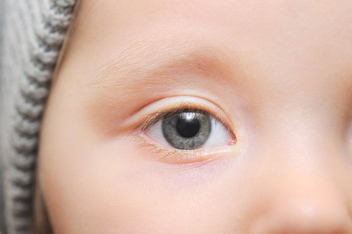 Fotos oculares analisadas por intelig&ecirc;ncia artificial diagnosticam autismo na inf&acirc;ncia com 100% de precis&atilde;o