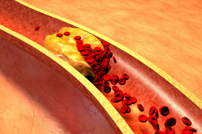 Interfaces cardiovasculares neuroimunes controlam a aterosclerose