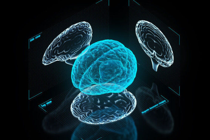 Medicamentos antiamiloides para o Alzheimer encolheram o c&eacute;rebro