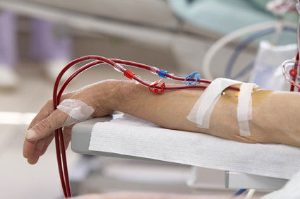 Novo protocolo canadense sugere que nefrologistas podem esperar mais tempo para iniciar a diálise em alguns pacientes com doença renal crônica