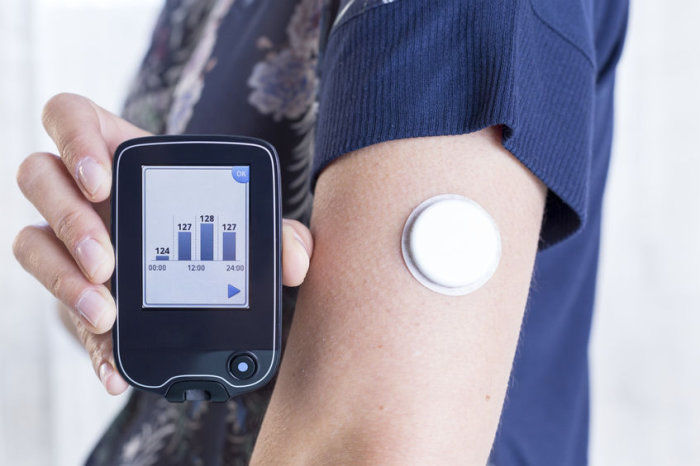 Pacientes com diabetes tipo 2 também podem se beneficiar do sistema de circuito totalmente fechado