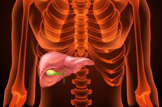 Semaglutida subcutânea para tratar esteatohepatite não alcoólica, em comparação com placebo, resulta em maior porcentagem de pacientes com resolução da doença
