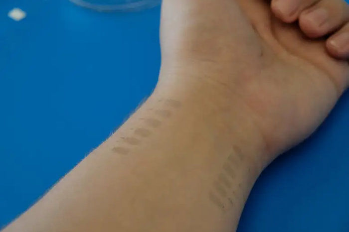Tatuagens temporárias de grafeno podem monitorar continuamente a pressão arterial