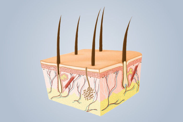 Tratamento t&oacute;pico para epiderm&oacute;lise bolhosa obt&eacute;m aprova&ccedil;&atilde;o da FDA