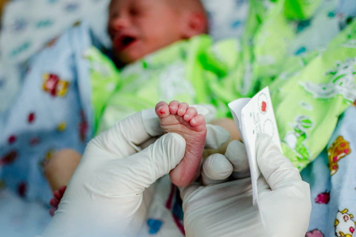 Triagem neonatal para atrofia muscular espinhal parece oferecer benef&iacute;cios funcionais
