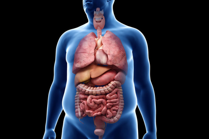 Cirurgia bariátrica pode reduzir o risco de doença hepática grave