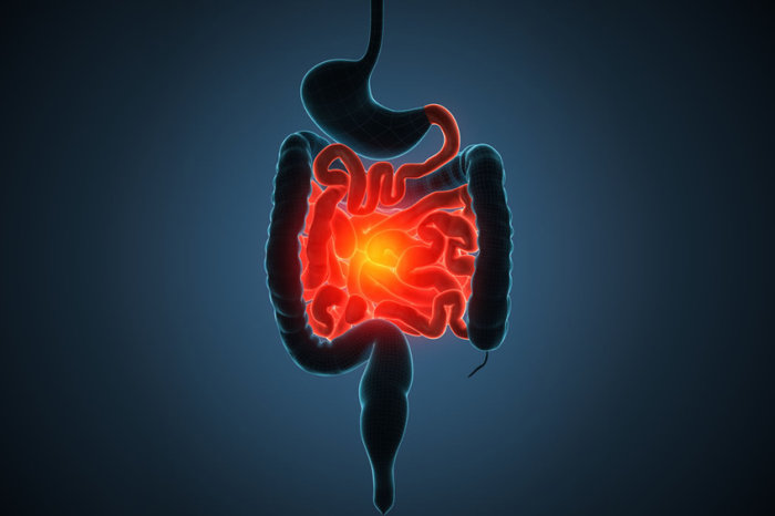 Descoberta uma das principais causas da doença inflamatória intestinal